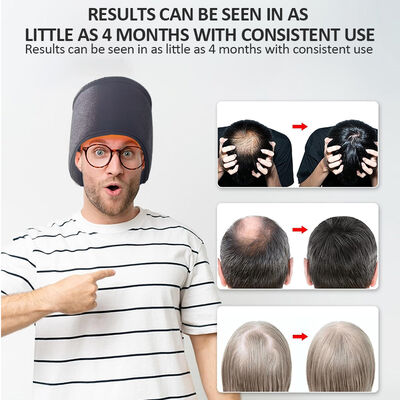 کلاه رشد مو 660 نانومتری با نور قرمز LED و 270 نور قرمز LED و کلاه لیزر درمانی